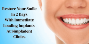 Read more about the article Restore Your Smile In 2 Days With Immediate Loading Implants At Simpladent Clinics