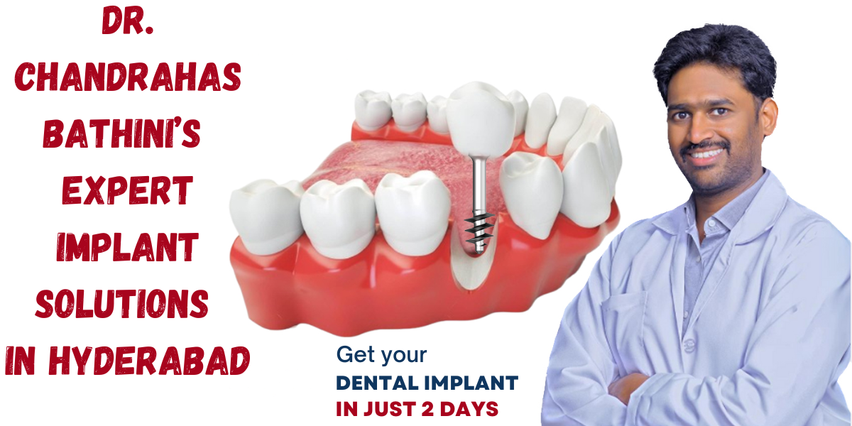 Renowned dental surgeon Dr. Chandrahas Bathini performing advanced dental implant procedures, expert in smile restoration and oral health solutions.