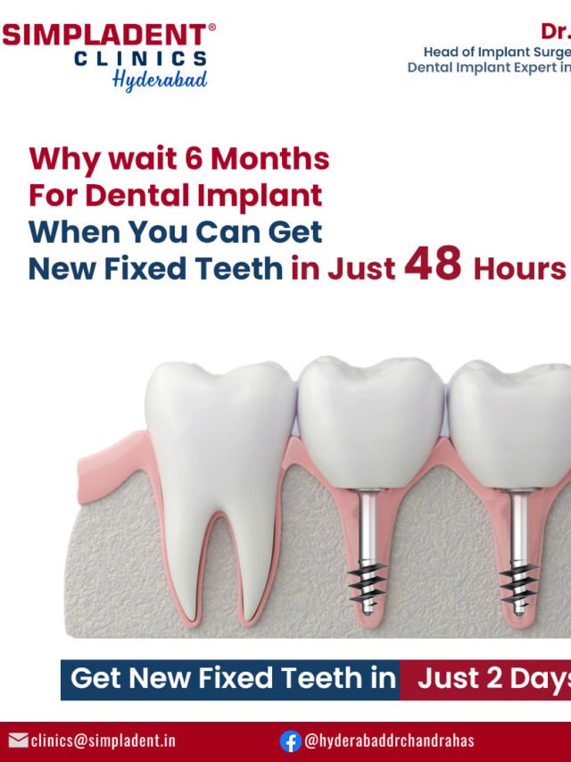Transform Your Smile in Just 48 Hours: The Ultimate Dental Makeover