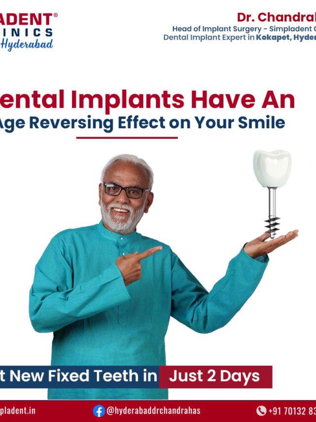 How Dental Implants Have an Age-Reversing Effect on Your Smile!