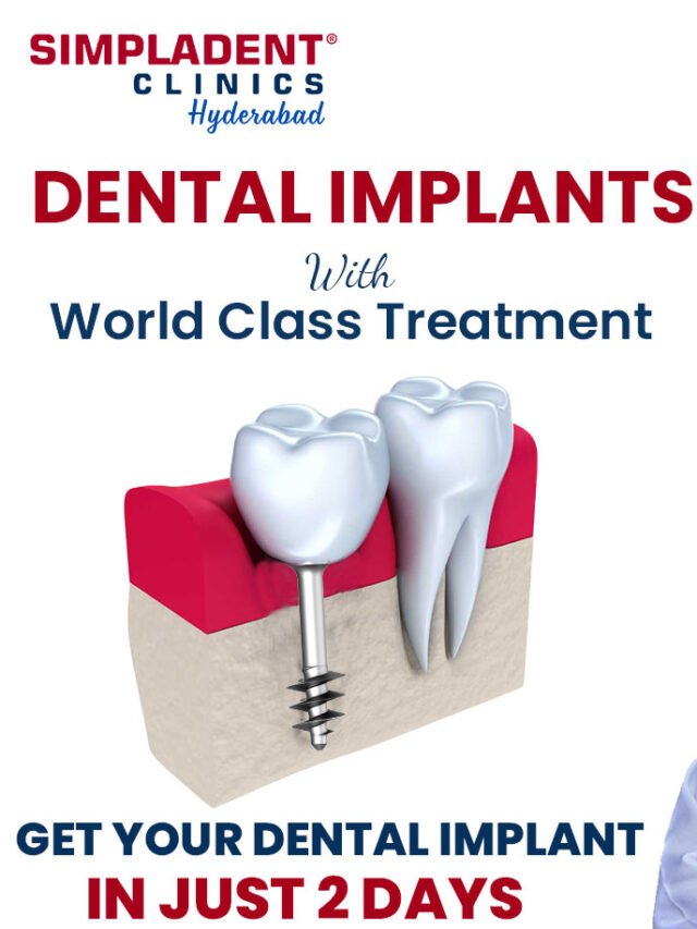 Experience Dental Implants With World-Class Treatment – A Life-Changing Smile Awaits!