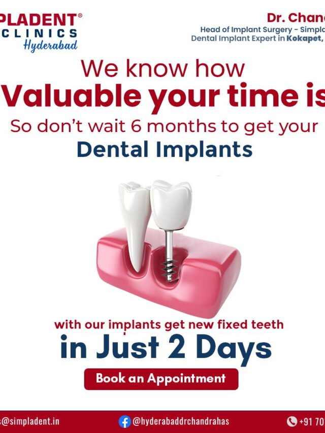 Get Your New Smile in Just 2 Days! – A Life-Changing Transformation