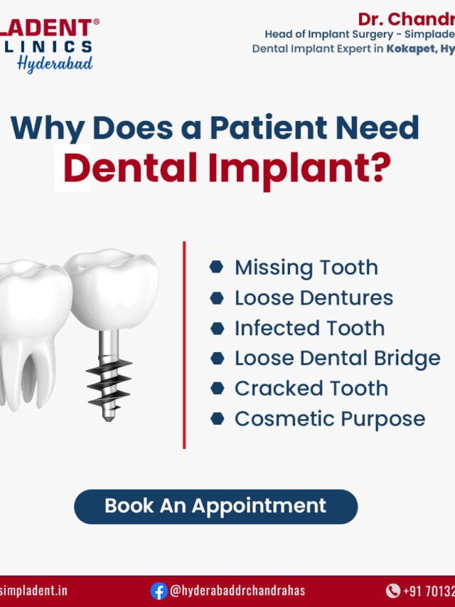 Restore Your Smile with Expert Dental Implants in Hyderabad – Fast, Reliable & Permanent