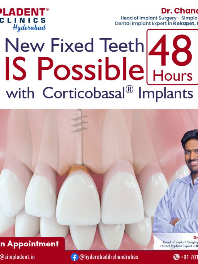 New Fixed Teeth Is Possible in Just 48 Hours! Experience the Fastest Smile Transformation