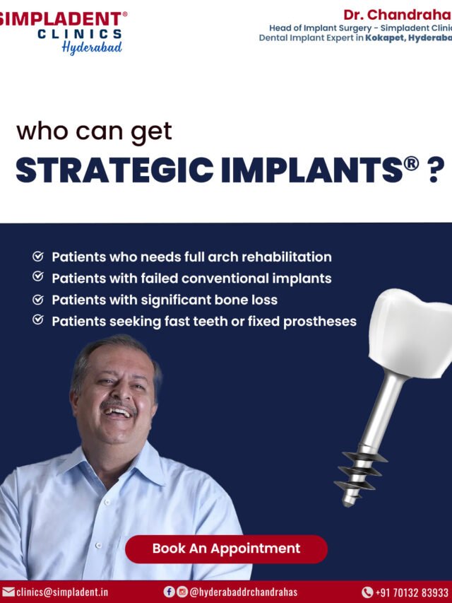 Struggling with Bone Loss or Failed Implants? Discover Advanced Dental Solutions That Last