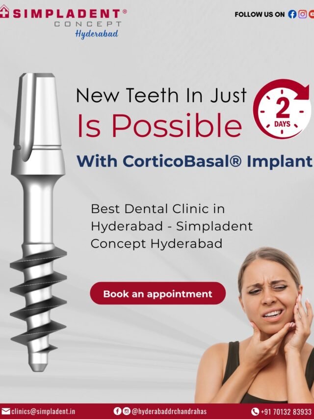 New Teeth in Just Days? Discover the Magic of CorticoBasal® Implants!