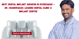 Read more about the article Best Dental Implant Surgeon in Hyderabad – Dr. Chandrahas: Leading Dental Clinic & Implant Centre