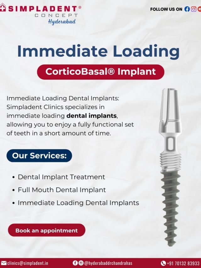 Immediate Loading Dental Implants: Get Your New Teeth in Just 2 Days!