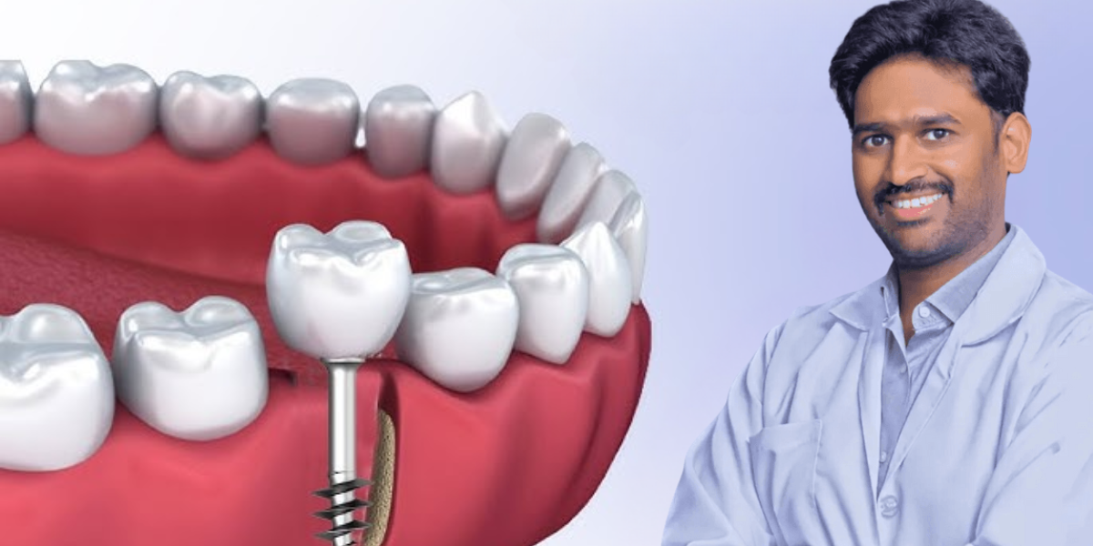 Dental Implant Surgeon expert, advanced implant dentistry, best dental implant specialist, painless dental implant treatment, permanent teeth replacement procedure by top implantologist