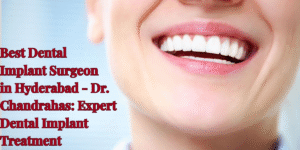 Read more about the article Best Dental Implant Surgeon in Hyderabad – Dr. Chandrahas: Expert Dental Implant Treatment