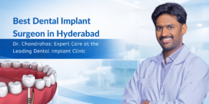 Read more about the article Best Dental Implant Surgeon in Hyderabad Dr. Chandrahas: Expert Care at the Leading Dental Implant Clinic